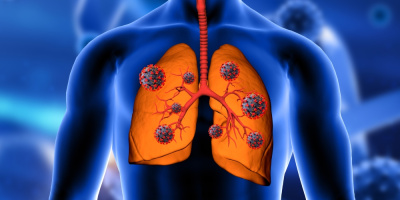 Семинар «Мониторинг эпидемических очагов туберкулезной инфекции и латентной туберкулезной инфекции», 9 апреля 2025 года