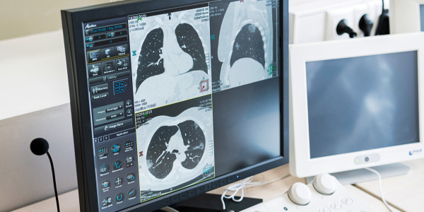 Компьютерное зрение