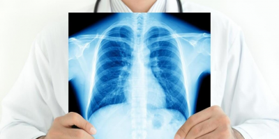 Онлайн-семинар «Совместная работа фтизиатрической и общей лечебной сети по профилактике и выявлению туберкулеза в амбулаторных условиях» 17 марта в 10:00