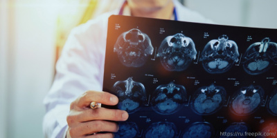 Конференция «Медицинская реабилитация пациентов с ОНМК», 18 октября 2023 года