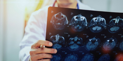 Конференция «Медицинская реабилитация пациентов с ОНМК», 18 октября 2023 года