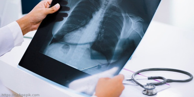 Семинар «Дифференциальная диагностика туберкулеза у детей и подростков» 16 июня в 10:00