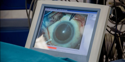 Офтальмологическая помощь в Москве в цифрах и фактах