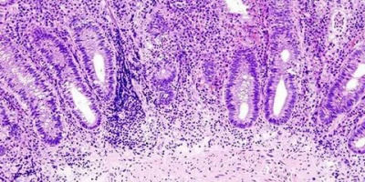 Научно-практическая конференция БСМЭ ДЗМ «Патоморфология инфекционных заболеваний» 30 сентября в 10:00