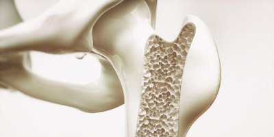 Запись вебинара «Остеопороз – немая эпидемия 21 века. Мнение травматолога» 20 октября