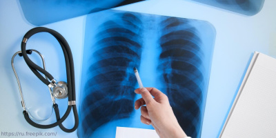 Актуальные зарубежные подходы к оценке качества лечения пациентов с ХОБЛ