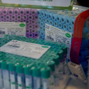 Специалисты НИИОЗММ расскажут об организации преаналитического этапа лабораторных исследований