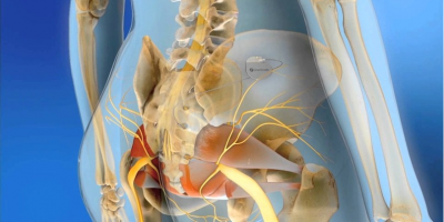 Сотрудник ОМО по урологии принял участие в курсе по сакральной нейромодуляции от ведущих специалистов ЕС