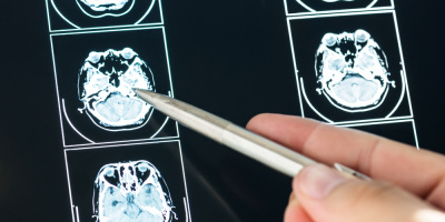 Вебинар «Возможность использования МРТ и фМРТ в работе психолога и логопеда», 26 августа 2022 года