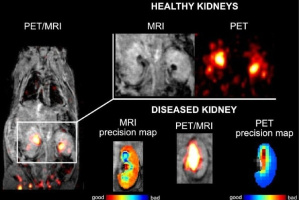 Новое контрастное вещество для ПЭТ/МРТ (Германия, Чехия) 