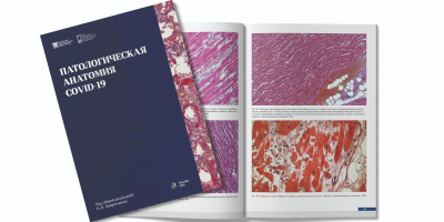 В НИИОЗММ ДЗМ издан атлас «Патологическая анатомия COVID-19»