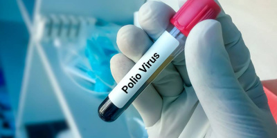 Вебинар «Полиомиелит и острые вялые параличи: современное состояние проблемы. Диагностика и профилактика», 28 апреля 2022 года