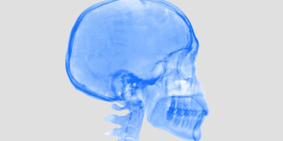 Конференция посвящена современному подходу к судебно-медицинской оценке черепно-мозговой травмы, 18 мая 2023 года