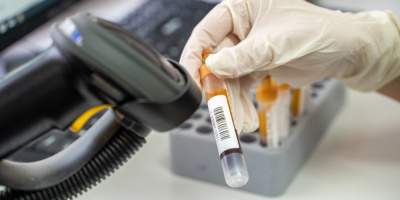 О диагностической роли короткоцепочечных жирных кислот у пациентов с ХСН и саркопенией