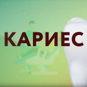 «Это должен знать каждый»: кариес