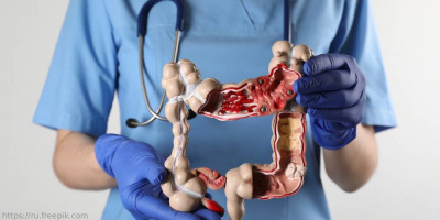 Конференция «Междисциплинарный подход к диагностике и лечению псевдомембранозного колита», 15 февраля 2022 года