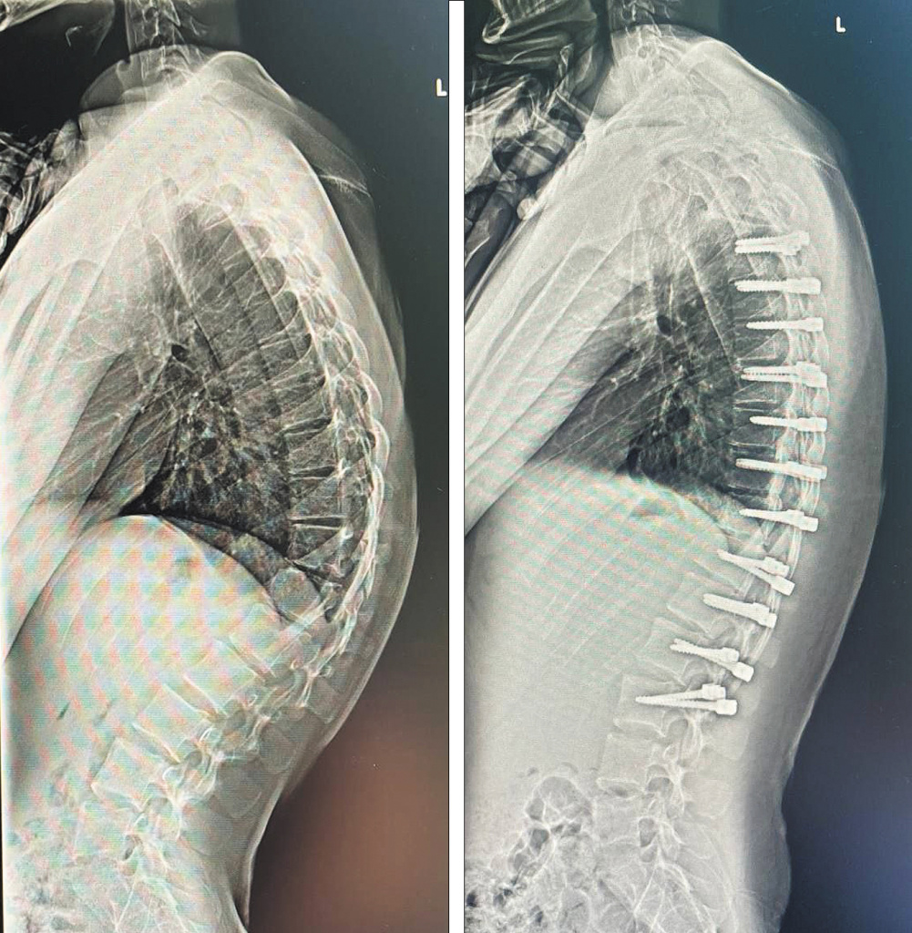 До и после операции